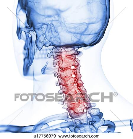 Illustration of the cervical spine View Large Photo Image Stock Photo - Illustration of the cervical spine. Fotosearch