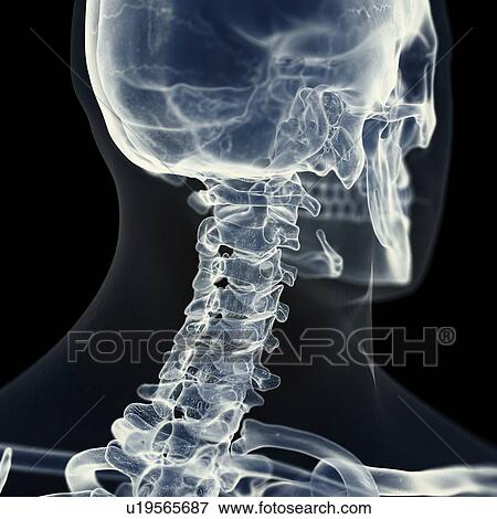 Stock Photo - Illustration of the cervical spine. Fotosearch