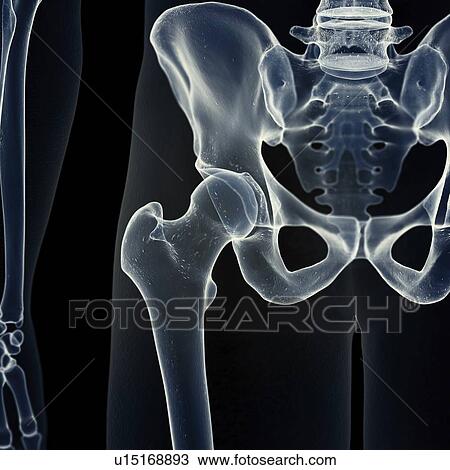 Illustration of the hip joint View Large Photo Image Stock Image - Illustration of the hip joint. Fotosearch