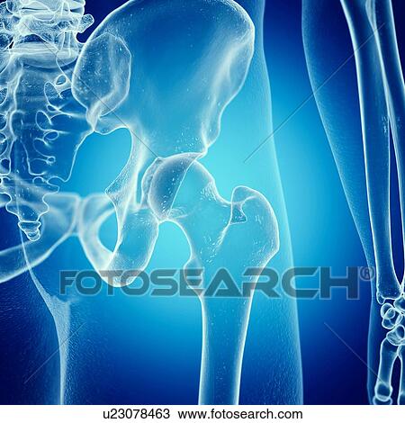 Stock Image - Illustration of the hip joint. Fotosearch