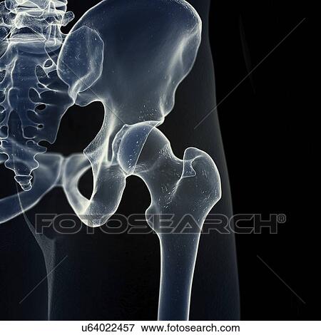 Illustration of the hip joint View Large Photo Image Stock Photo - Illustration of the hip joint. Fotosearch