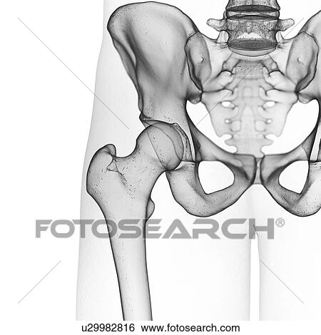 Stock Photograph - Illustration of the hip joint. Fotosearch