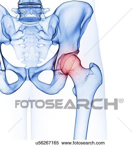 Illustration of the hip joint View Large Photo Image Stock Photography - Illustration of the hip joint. Fotosearch