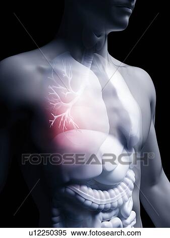 Stock Photography - Illustration of the human bronchi. Fotosearch