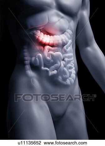 Illustration of the human large intestine View Large Photo Image Stock Image - Illustration of the human large intestine. Fotosearch