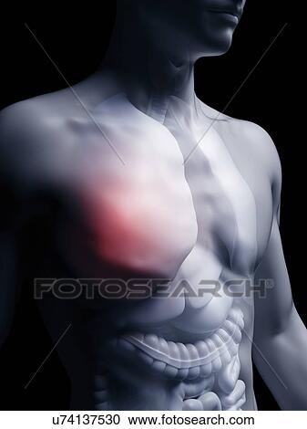Illustration of the human lung View Large Photo Image Stock Image - Illustration of the human lung. Fotosearch