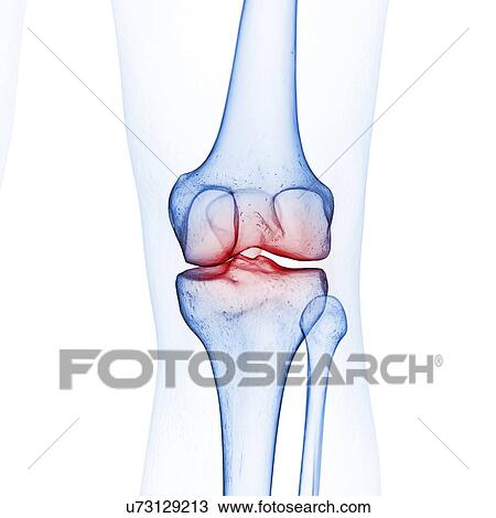 Illustration of the knee bones View Large Photo Image Stock Image - Illustration of the knee bones. Fotosearch