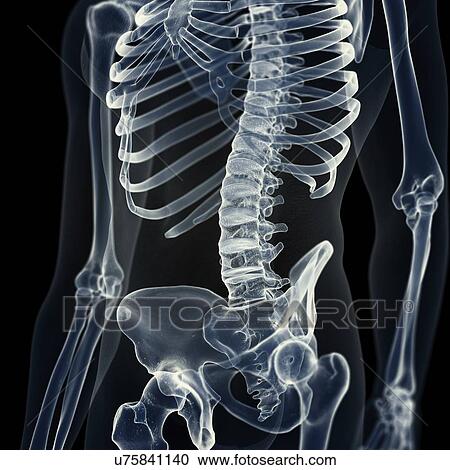Stock Image - Illustration of the lumbar spine. Fotosearch