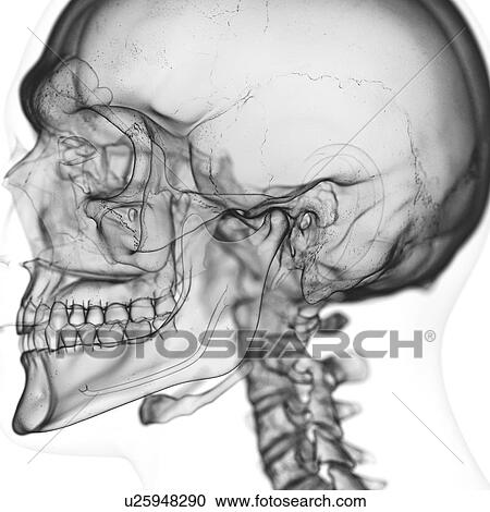 Stock Image - Illustration of the temporomandibular joint. Fotosearch