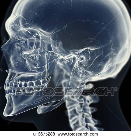 Stock Photo - Illustration of the temporomandibular joint. Fotosearch