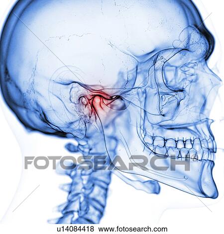Stock Photo - Illustration of the temporomandibular joint. Fotosearch