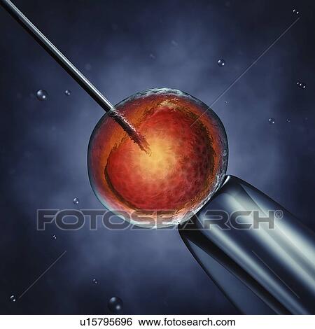 In vitro fertilization, illustration View Large Photo Image Stock Photograph - In vitro fertilization, illustration. Fotosearch
