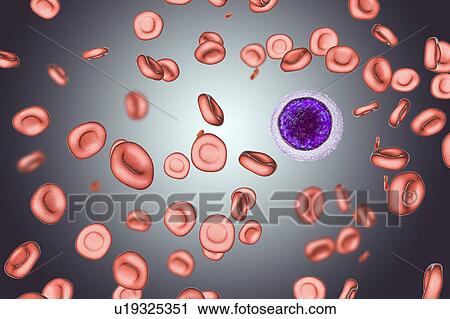 Stock Image - Iron deficiency anaemia, illustration. Fotosearch