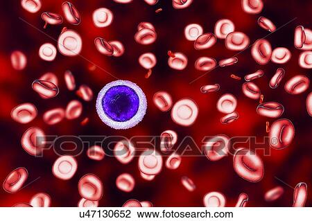 Stock Image - Iron deficiency anaemia, illustration. Fotosearch