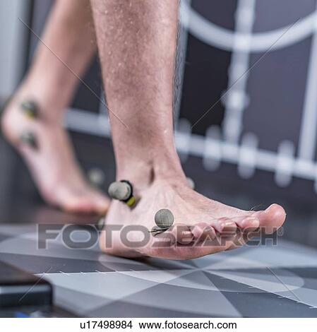 Picture - Markers for gait analysis. Fotosearch