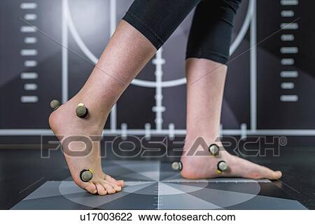 Stock Image - Markers for gait analysis. Fotosearch