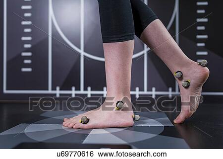 Stock Photograph - Markers for gait analysis. Fotosearch
