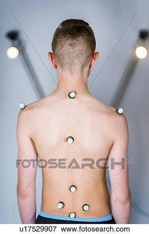 Stock Photo - Markers for posture analysis. Fotosearch