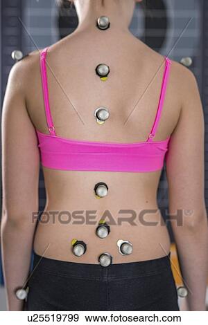 Stock Photo - Markers for posture analysis. Fotosearch