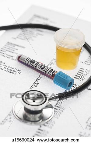 Picture - Medical check-up including blood and urine test samples and result.. Fotosearch