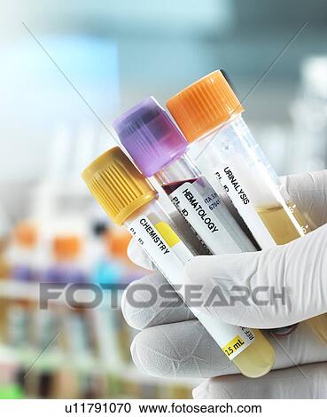 Medical tests View Large Photo Image Stock Image - Medical tests. Fotosearch