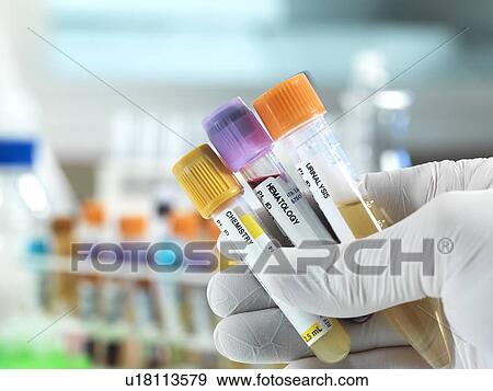 Medical tests View Large Photo Image Stock Photo - Medical tests. Fotosearch