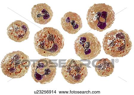 Picture - Meningococcal meningitis, illustration. Fotosearch