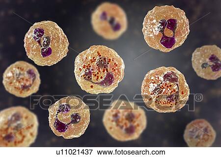 Meningococcal meningitis, illustration View Large Photo Image Stock Photo - Meningococcal meningitis, illustration. Fotosearch