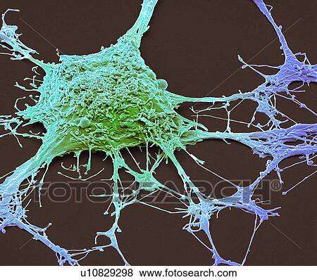 Stock Photo - Neurone. Scanning electron micrograph (SEM) of a PC12 neurone in culture. The PC12 cell line, developed from a pheochromocytoma tumor of the rat adrenal medulla, has become a premiere model for the study of neuronal differentiation. When treated in.... Fotosearch