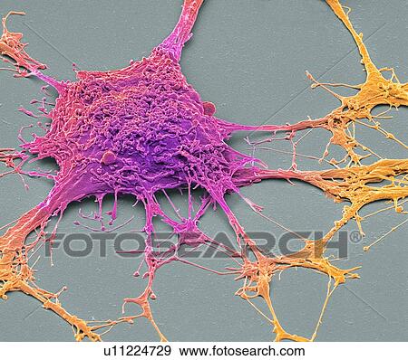 Stock Photo - Neurone. Scanning electron micrograph (SEM) of a PC12 neurone in culture. The PC12 cell line, developed from a pheochromocytoma tumor of the rat adrenal medulla, has become a premiere model for the study of neuronal differentiation. When treated in.... Fotosearch
