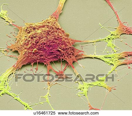 Stock Photography - Neurone. Scanning electron micrograph (SEM) of a PC12 neurone in culture. The PC12 cell line, developed from a pheochromocytoma tumor of the rat adrenal medulla, has become a premiere model for the study of neuronal differentiation. When treated in.... Fotosearch