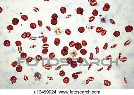 Normal blood smear, illustration View Large Photo Image Picture - Normal blood smear, illustration. Fotosearch