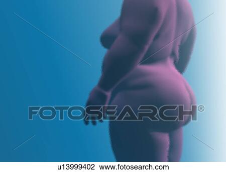 Obese woman, conceptual illustration. View Large Photo Image Stock Image - Obese woman, conceptual illustration.. Fotosearch