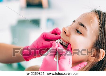 Stock Photography - Orthodontist fixing girl's dental braces.. Fotosearch