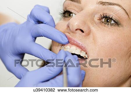 Stock Image - Orthodontist tightening braces. Fotosearch