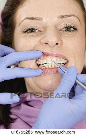 Stock Photography - Orthodontist tightening braces. Fotosearch