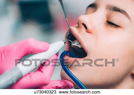 Stock Image - Orthodontist working with little girl, cleaning dental braces.. Fotosearch