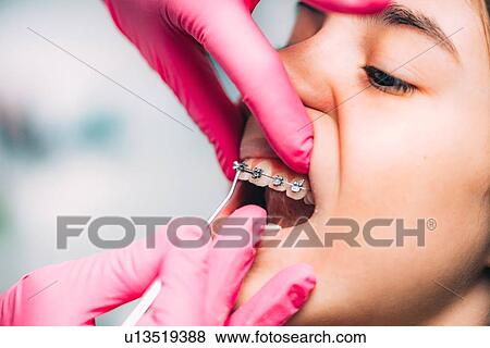 Stock Photo - Orthodontist working with little girl, checking her dental braces.. Fotosearch
