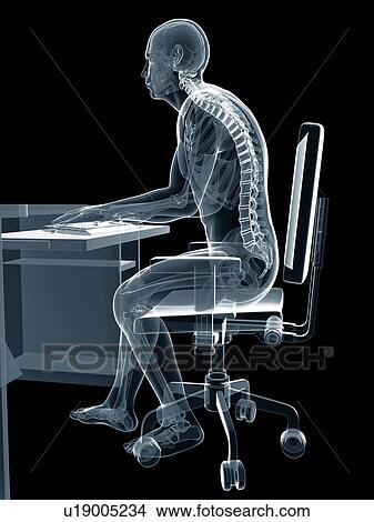 Picture - Person sitting with incorrect posture. Fotosearch