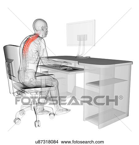 Picture - Person sitting with incorrect posture. Fotosearch