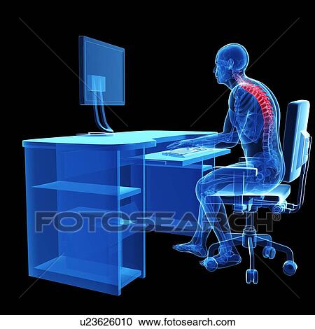 Person sitting with incorrect posture View Large Photo Image Stock Image - Person sitting with incorrect posture. Fotosearch