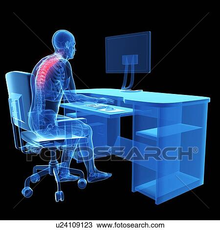 Person sitting with incorrect posture View Large Photo Image Stock Image - Person sitting with incorrect posture. Fotosearch