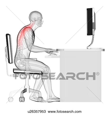 Stock Image - Person sitting with incorrect posture. Fotosearch