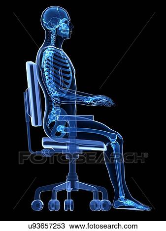 Stock Image - Person sitting with incorrect posture. Fotosearch