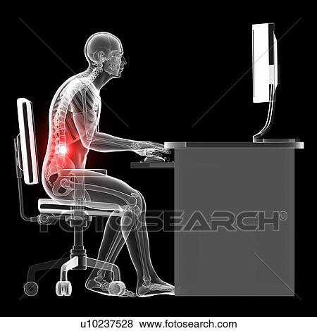 Stock Photo - Person sitting with incorrect posture. Fotosearch