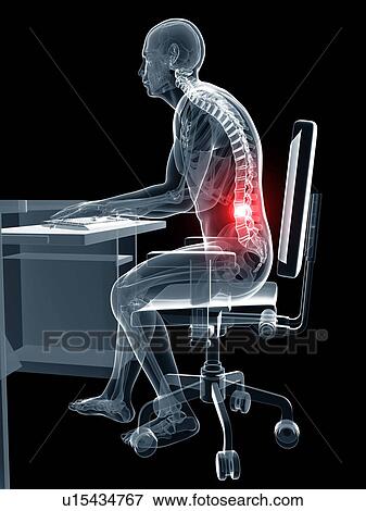 Person sitting with incorrect posture View Large Photo Image Stock Photo - Person sitting with incorrect posture. Fotosearch
