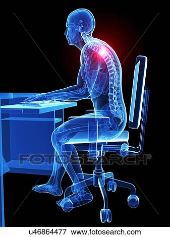 Person sitting with incorrect posture View Large Photo Image Stock Photo - Person sitting with incorrect posture. Fotosearch