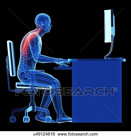 Stock Photograph - Person sitting with incorrect posture. Fotosearch