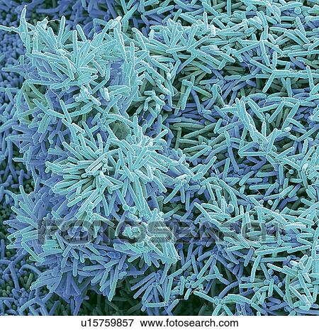 Plaque-forming bacteria, SEM View Large Photo Image Stock Photo - Plaque-forming bacteria, SEM. Fotosearch