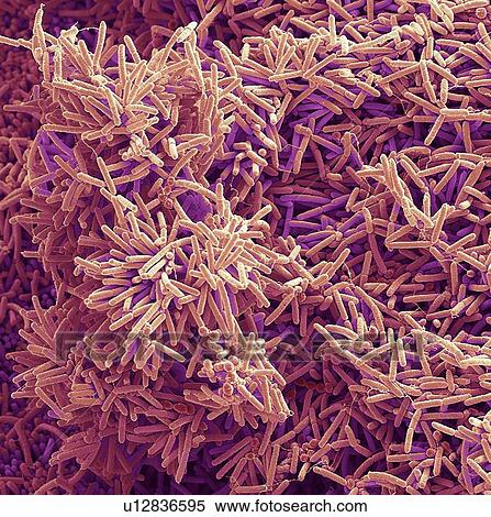Stock Photography - Plaque-forming bacteria, SEM. Fotosearch